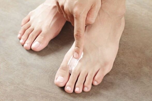 aplicación de ungüentos do fungo da pel nas pernas